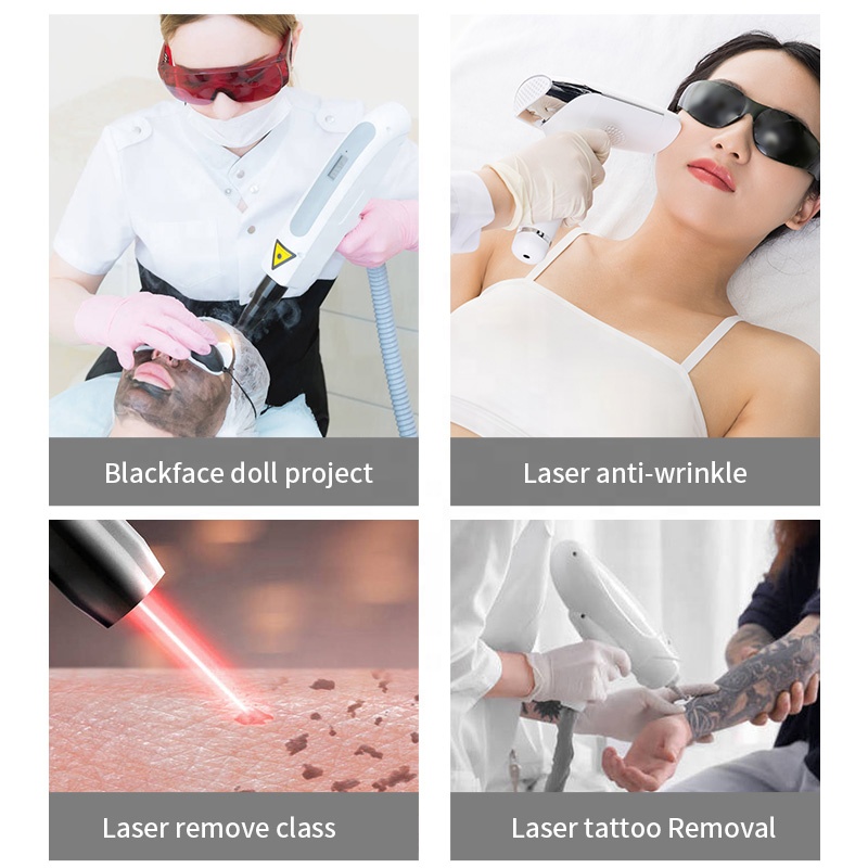 Aspiratore di Fumo per Trattam - Industrial Laser Price recensione e prezzo